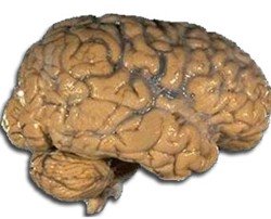 Interesting facts about human brain